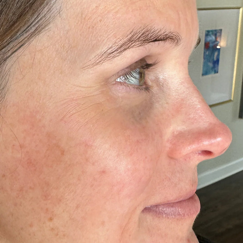 Before applying PDRN Pink Collagen Volume Multi Balm