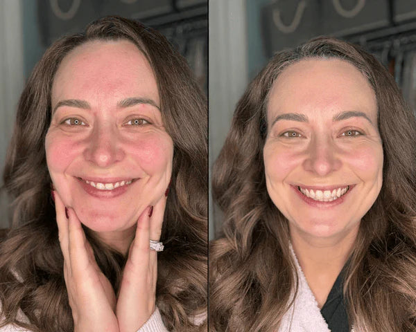 PDRN Pink Collagen Volume Multi Balm customer review from Laura M.