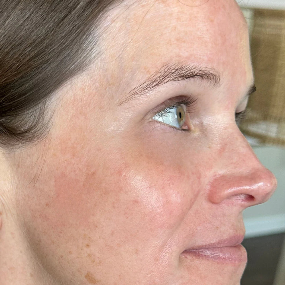 After applying PDRN Pink Collagen Volume Multi Balm