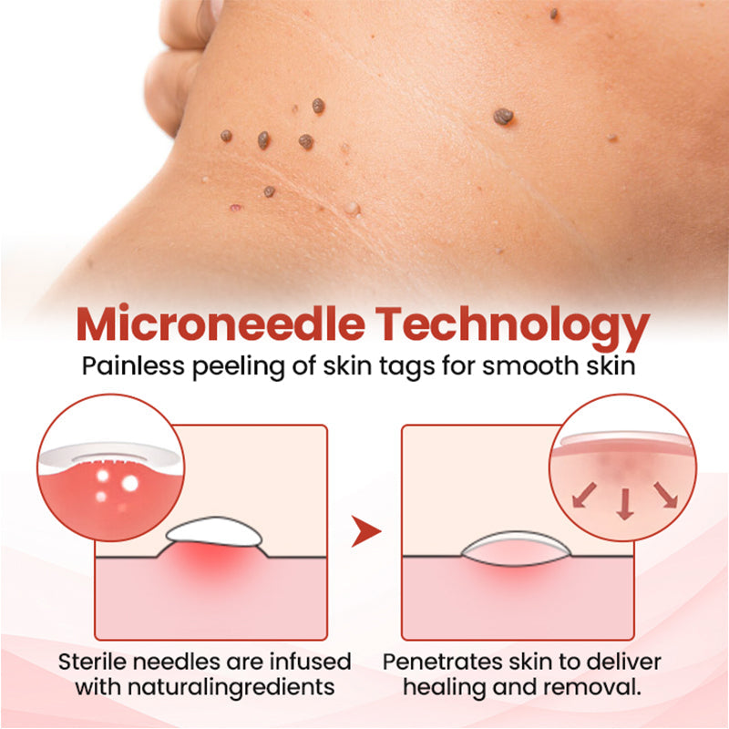💥painless micro-patch🔥